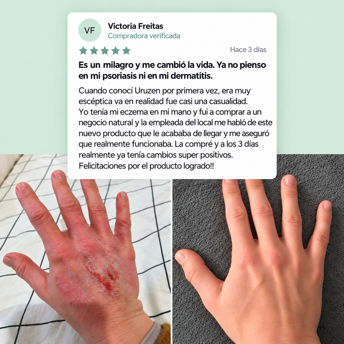 Calma la Picazón y la Resequedad de tu Piel