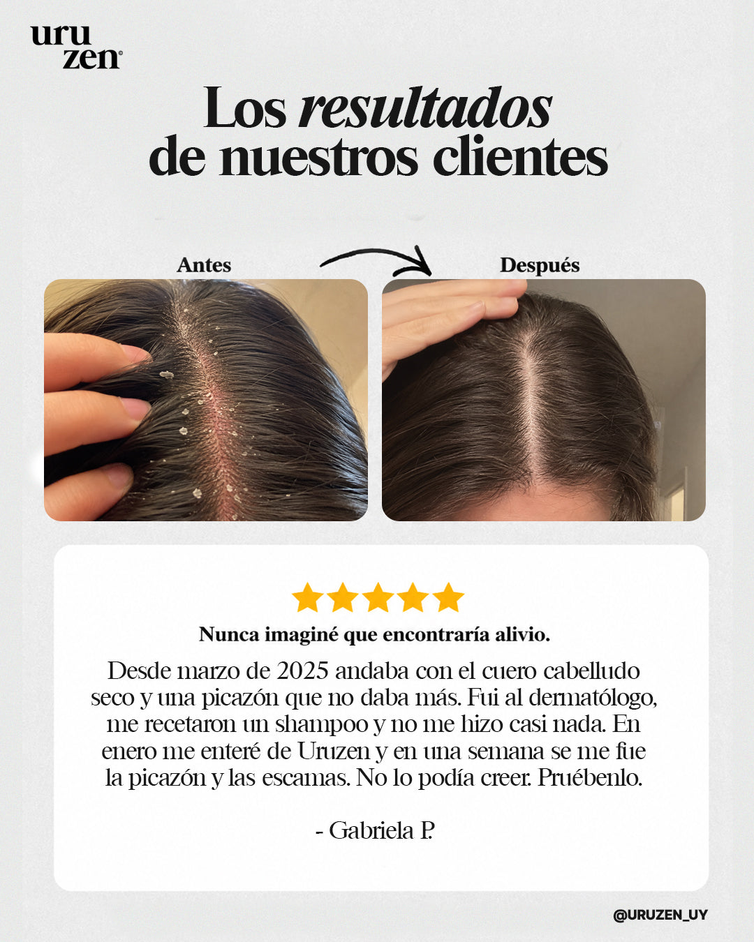Elimina La Descamación y Picazón De Raíz